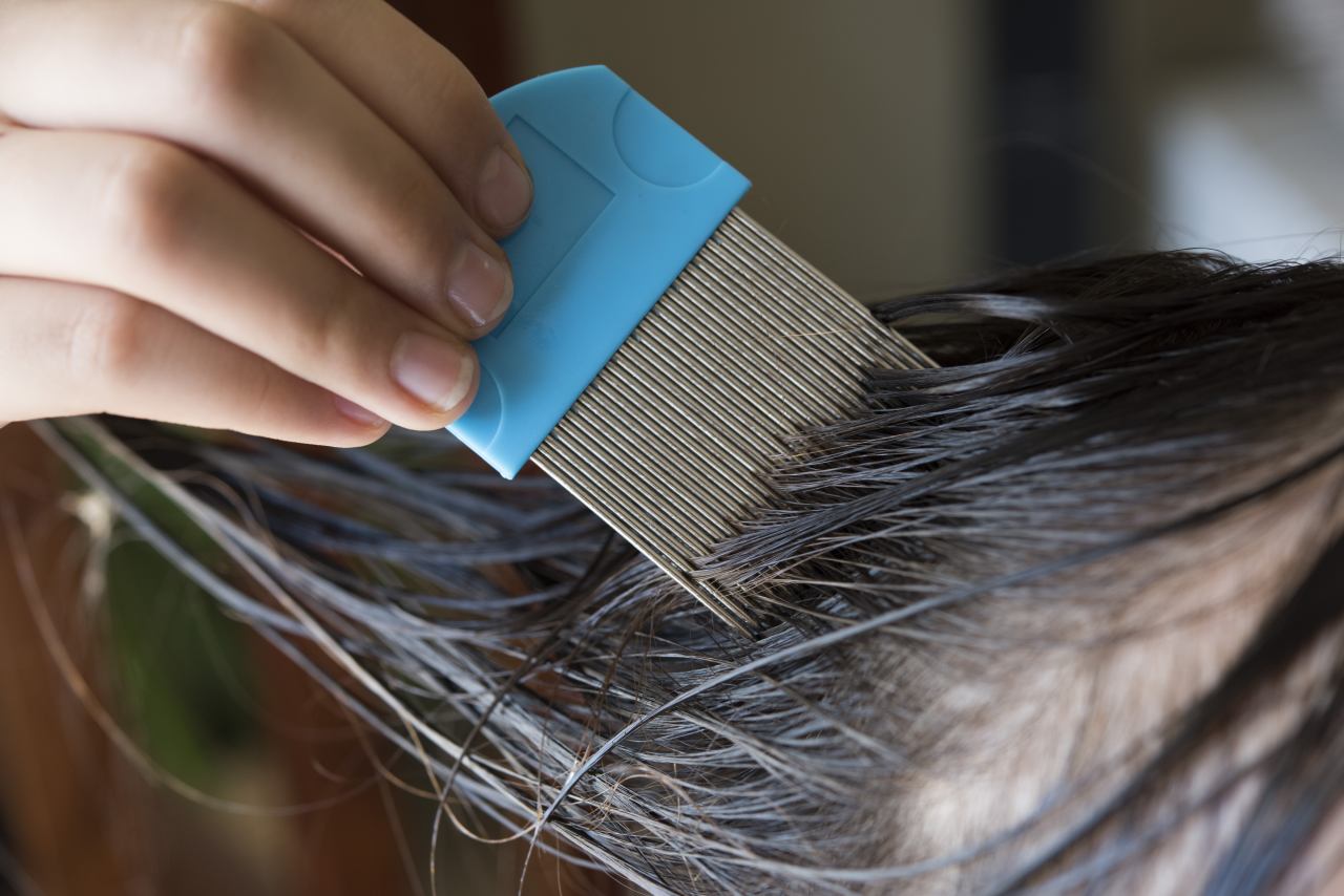 Langkah Cara Menghilangkan Kutu Rambut dengan Cepat dan Aman - Official Astronauts Blog